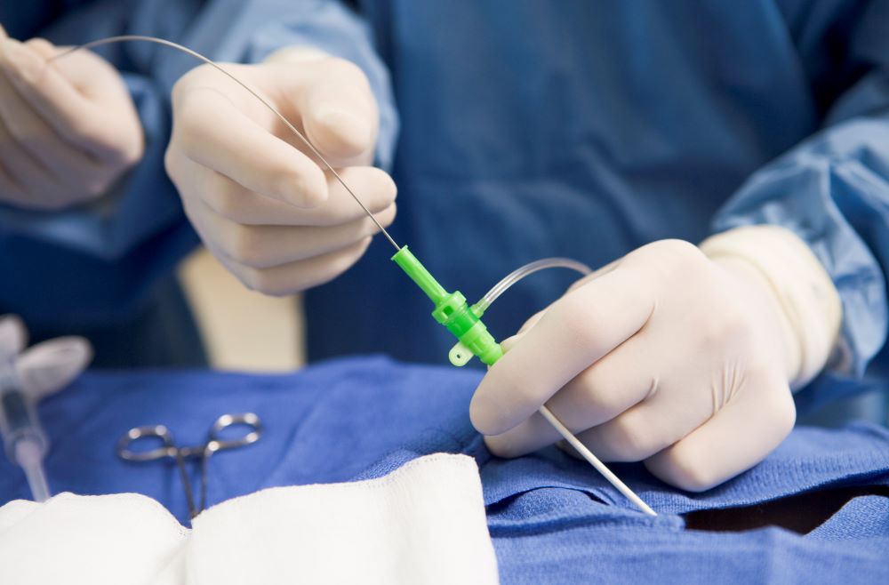 Everything You Need To Know About Cardiac Catheterization
